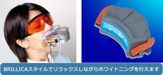 レーザーホワイトニング